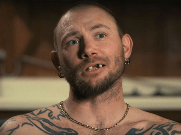 Study: 1 Out of 10 Dentists Hate&nbsp;Teeth